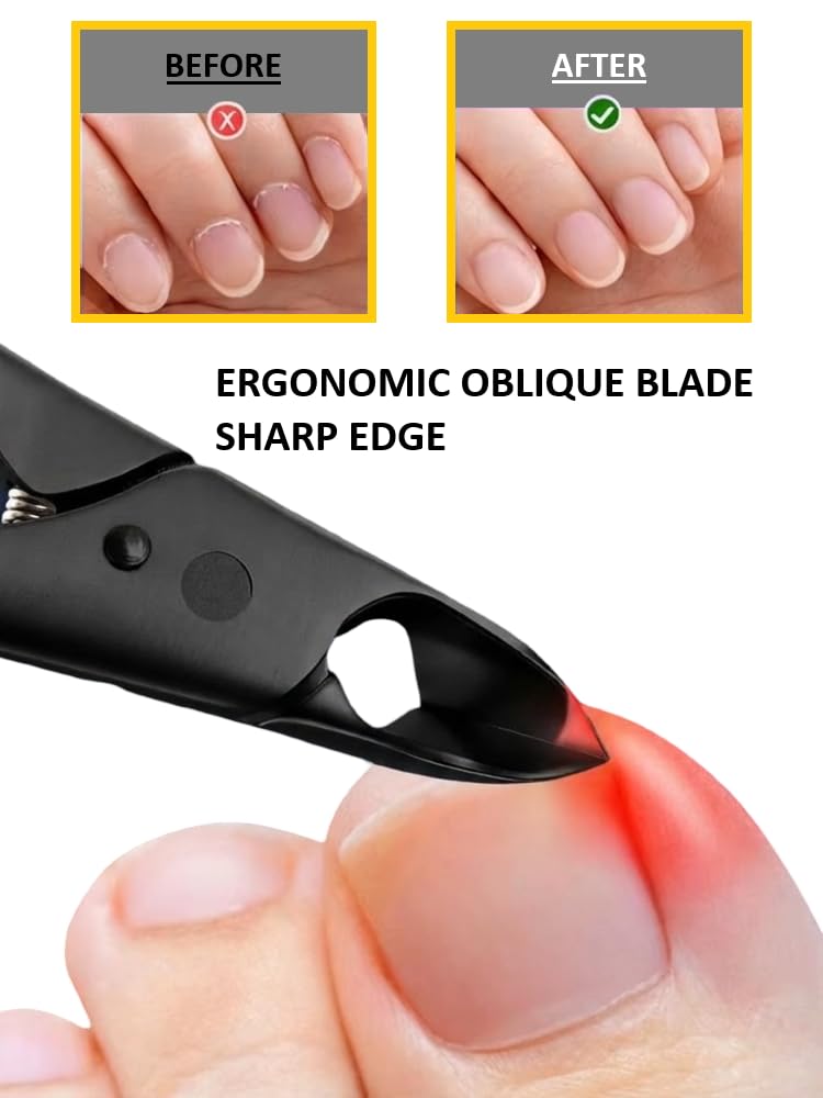 Germany - Apexay Cuticle Nippers -Stainless Steel Cuticle Clippers with Built-in spring Design, Ultra-Sharp Precision Blades for Manicure, Pedicure & Dead Skin Removal (Black)