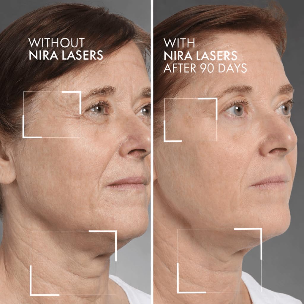 NIRA Pro 3 Laser - FDA-Cleared-At-Home Anti Aging Device for Wrinkle Reduction & Collagen Stimulation, Full Face & Neck Treatment, Pain-Free, Clinically Proven