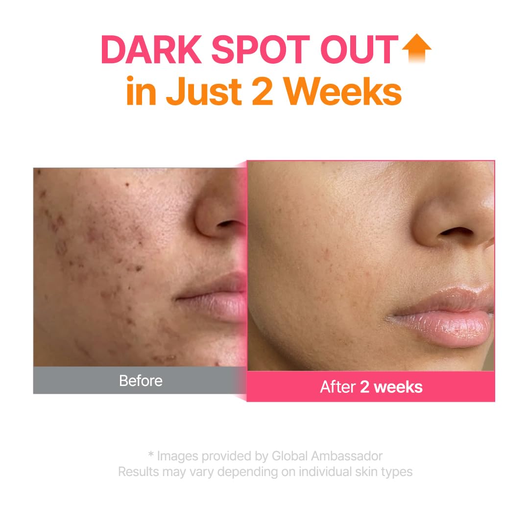 PURITO TXA 6% + Niacinamide 10% Facial Serum | for Dark Spots, Hyperpigmentation, Uneven Skin Tone | High-Concentration Tranexamic Acid | Korean Skincare, 30mL 1.01 fl.oz