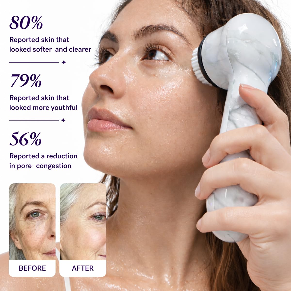 Michael Todd Beauty Soniclear Allure 2026 Readers Choice Winner Sonic (no Rotating) Facial Cleansing + Exfoliation Brush for Men/Women, Antimicrobial Protected Bristles, 4 speeds, Serum Infusion Head