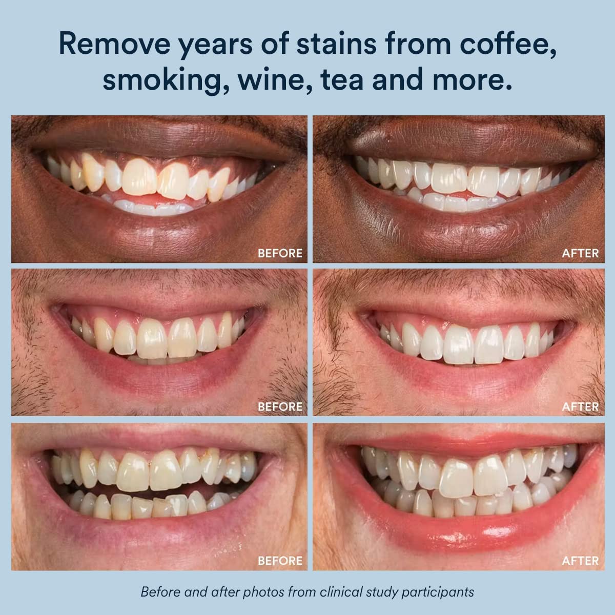 Auraglow Teeth Whitening Gel for Toothpaste, 9% Hydrogen Peroxide, Add to Toothpaste to Whiten, 350+ Whitening Treatments, Removes Coffee Wine Tea Stains, No Trays or Strips, Made in USA, 2.6oz
