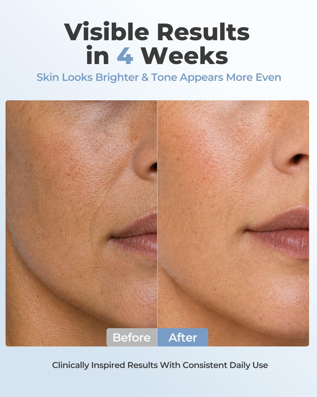 VIVCHIC LED Face Mask, FDA Cleared Red Light Therapy for At-Home Anti Aging
