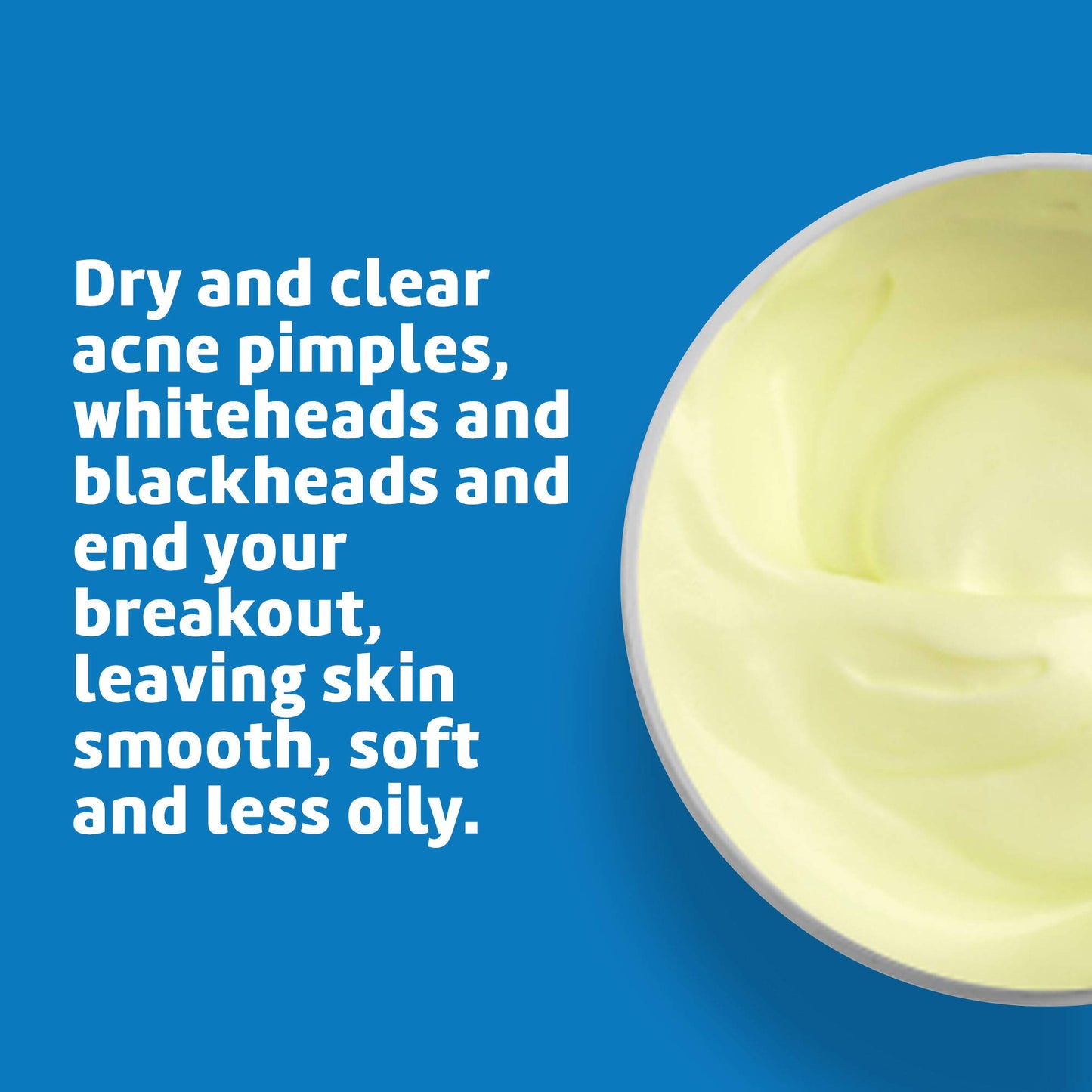 De La Cruz Sulfur Ointment - Cystic Acne Treatment for Face and Body - Daily 10 Min Spot Treatment Mask - Safe and Effective Game Changing Hormonal Acne Treatment that Clears Up Pimples 5.5 OZ.