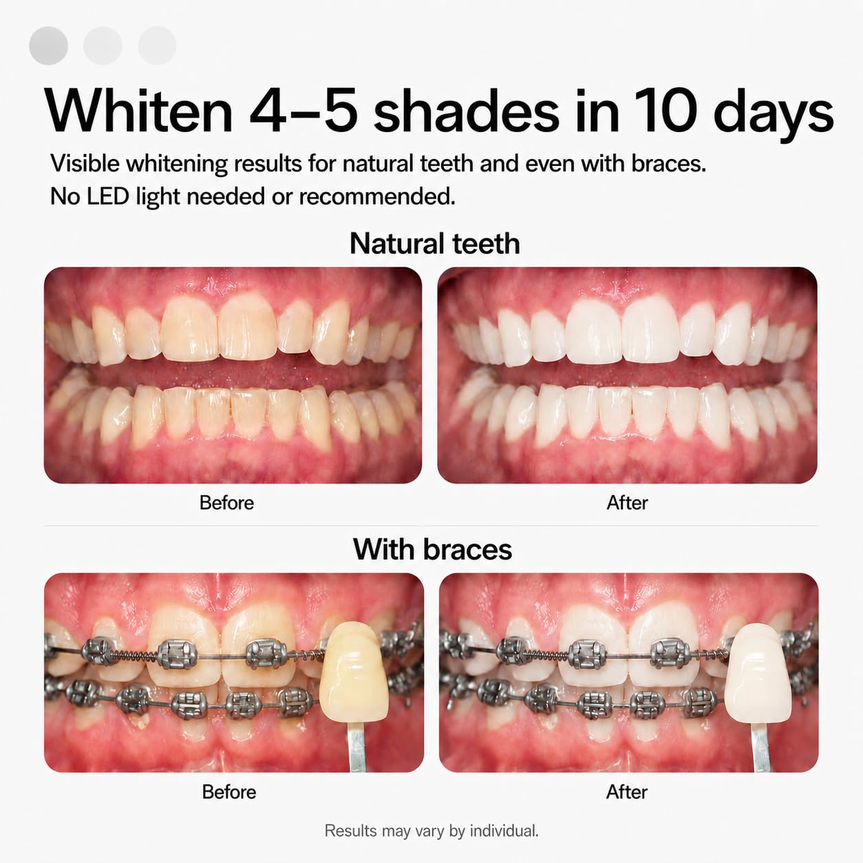 Opalescence GO 15 Whitening Bundle - (7 Treatments) Hydrogen Peroxide Prefilled Teeth Whitening Trays and Travel Sensitive Whitening Toothpaste 1 Oz - Mint Flavor- Includes a Toothbrush - 6288-1T