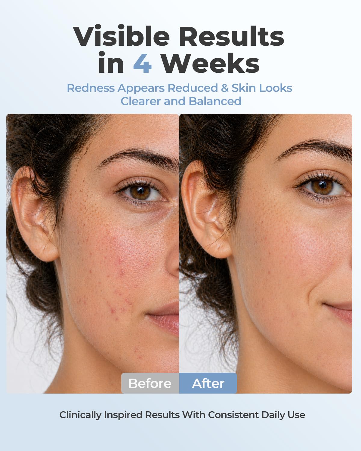 VIVCHIC LED Face Mask, FDA Cleared Red Light Therapy for At-Home Anti Aging