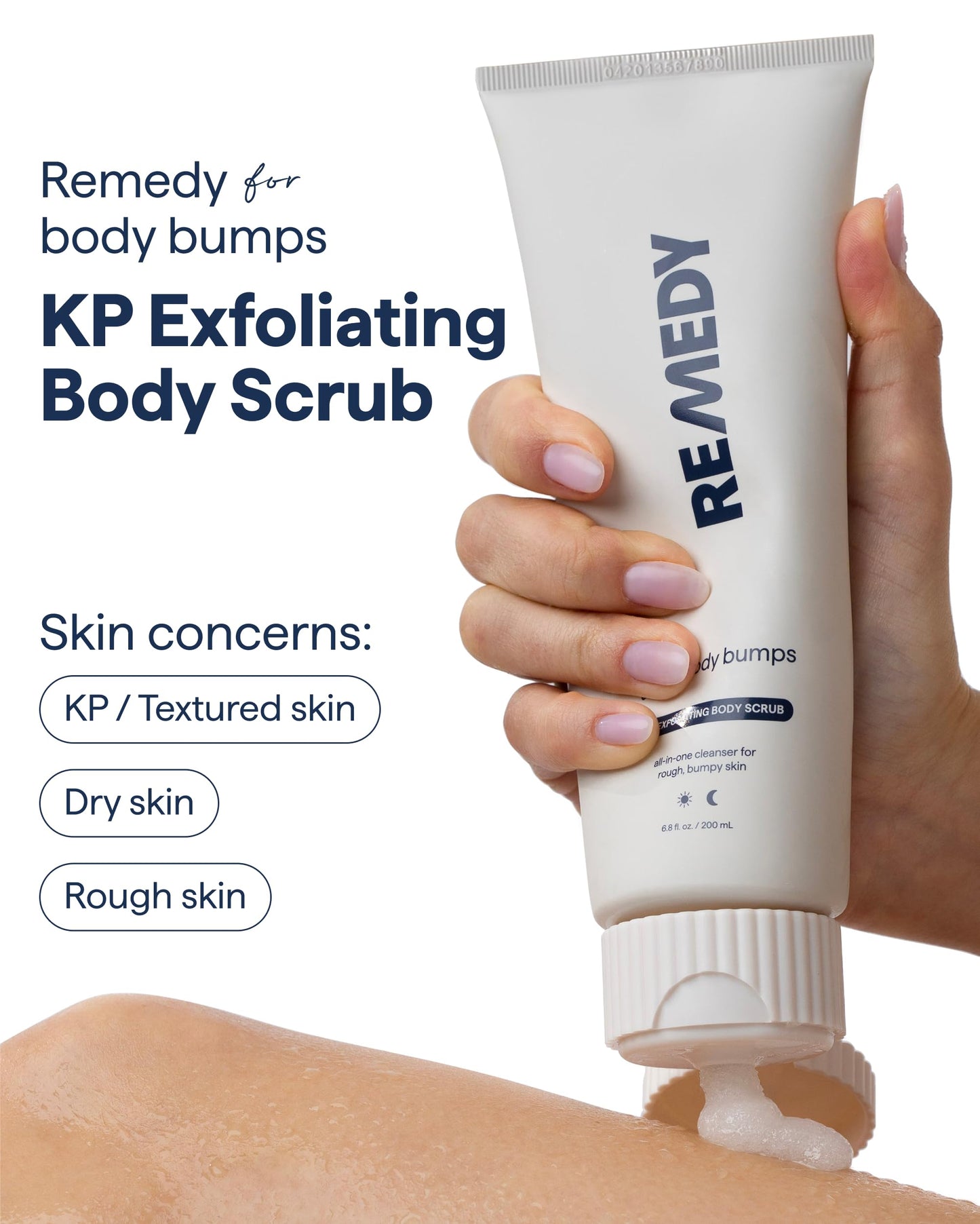 Remedy KP Exfoliating Body Scrub | Keratosis Pilaris and Chicken Skin Treatment with Fine Sugar, Glycolic Acid, Lactic Acid and Squalane | Exfoliating Scrub | By Dermatologist Dr. Shah, 6.8 fl oz
