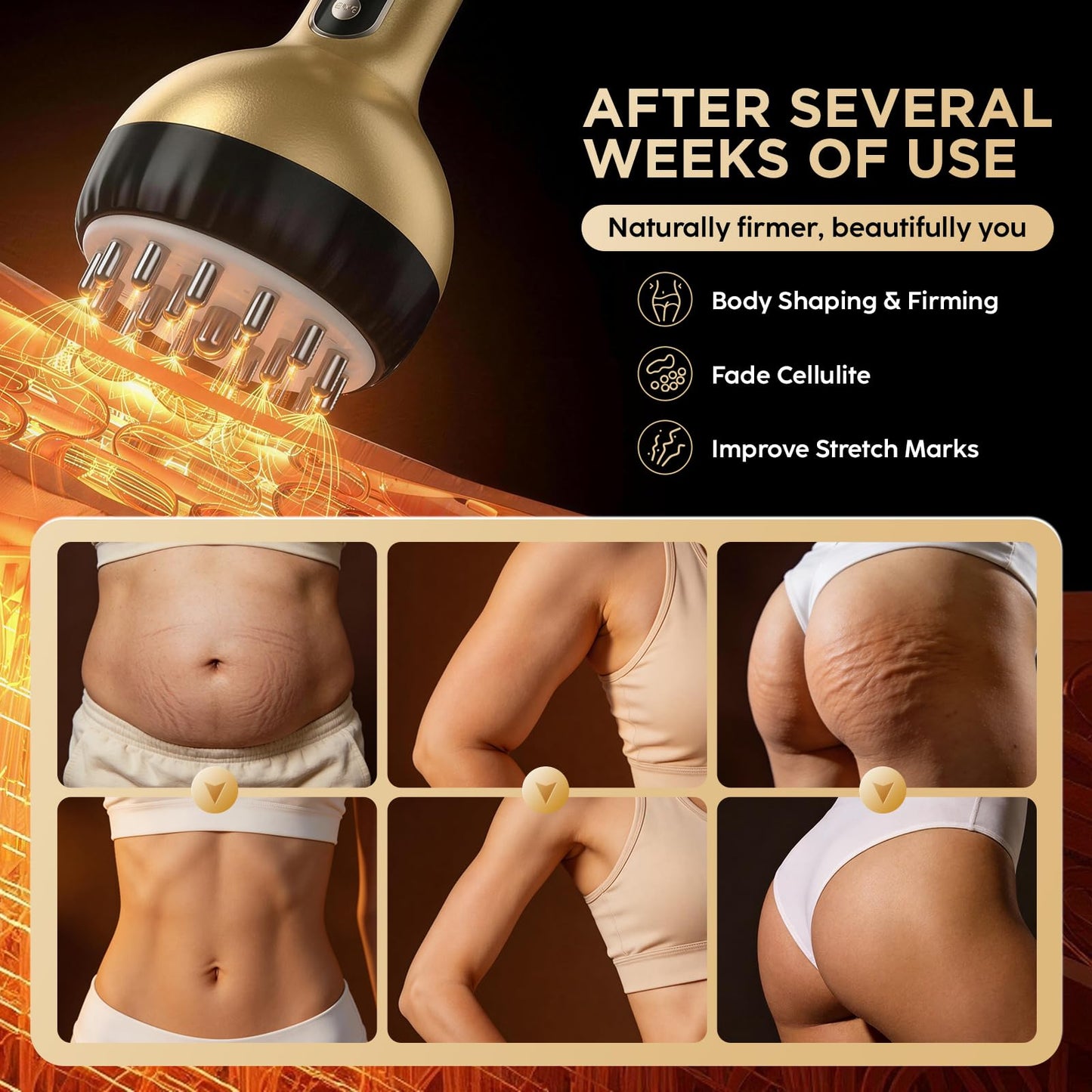 OVGIAP Lymphatic Drainage Massager & Anti-Cellulite Massage Tool, Body Sculpting Device for Legs, Arms & Stomach, Supports Smoother Skin, with Gentle Warming & Vibration (Gilded)