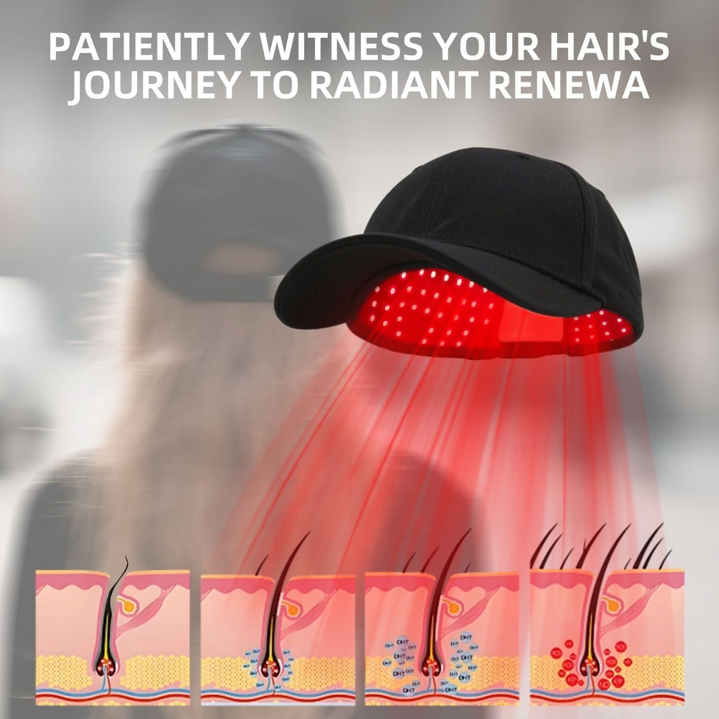 Red Light Therapy for Hair, Hair Loss Treatments Hat
