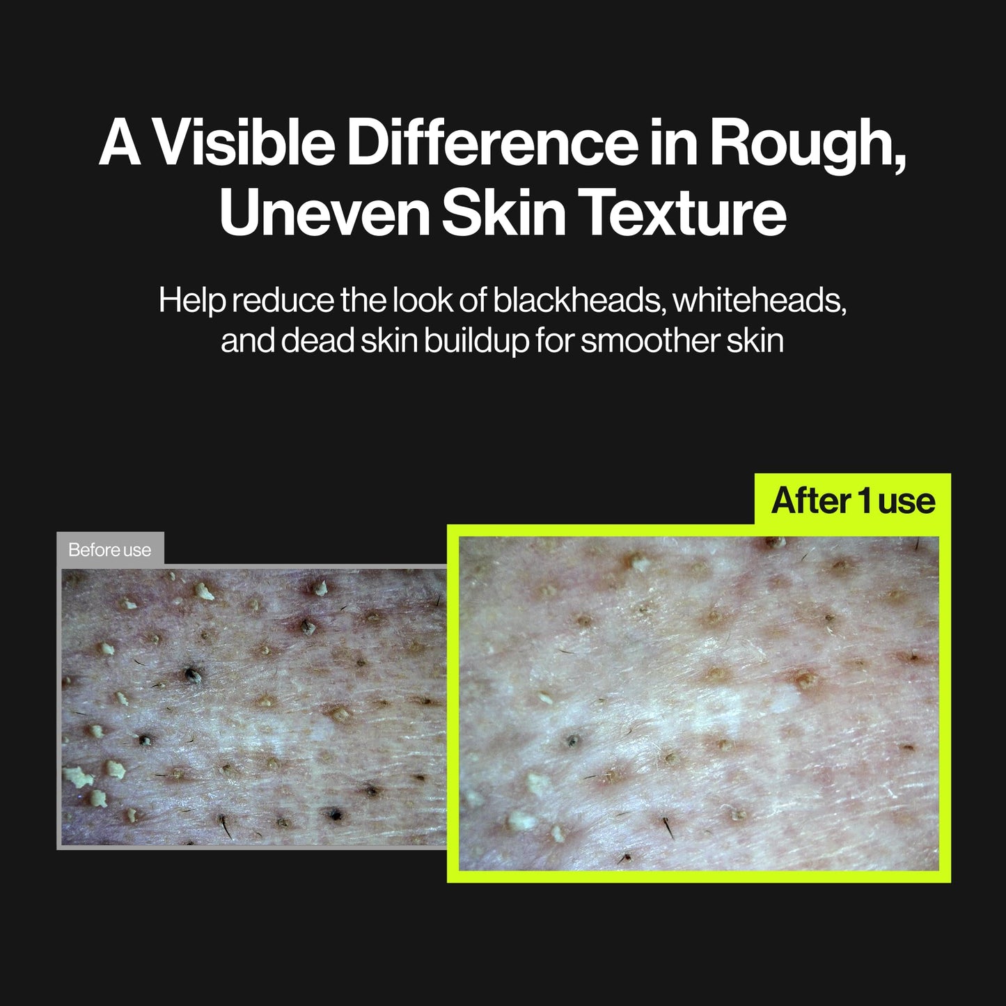 UNLEASHIA 2-Step Zero Pore Overnight Bubble Mask | 8-Pore Exfoliant & Barrier Care with AHA, BHA, PHA, LHA, Niacinamide, Panthenol, Ectoin & Ceramide NP, Sensitive Skin, Korean Skincare, 2.71 Fl Oz