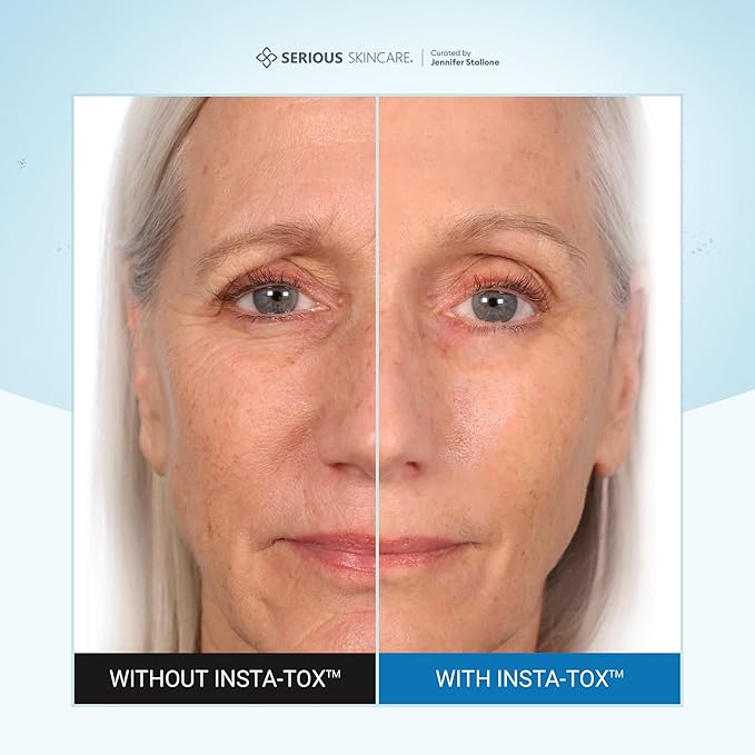 Serious Skincare INSTA-TOX Instant Wrinkle Filler for Face Serum, to Smooth + Blur Fine Lines, Deep Wrinkles, Lip Lines, Crow’s Feet & Pores, Temporary Face Tightener, .75 oz