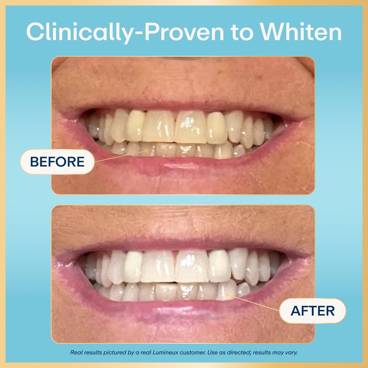 Lumineux 2-in-1 Whitening Pen Enamel Safe and Clinically Proven to Whiten Without The Sensitivity - Removes Coffee, Tea, and Smoking Stains