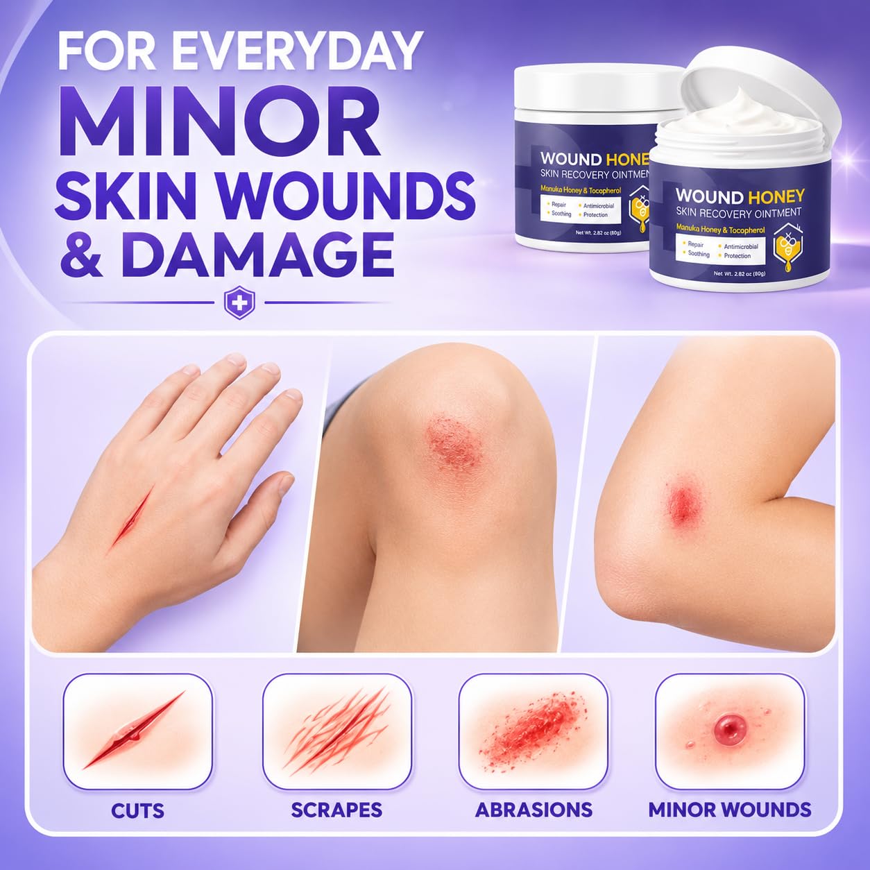 OHEAL Manuka Honey Wound Care Ointment – Moisturizing Barrier Balm for Minor Cuts, Scrapes, Abrasions & Dry Cracked Skin, Gentle Formula for skin care, 2.82 oz