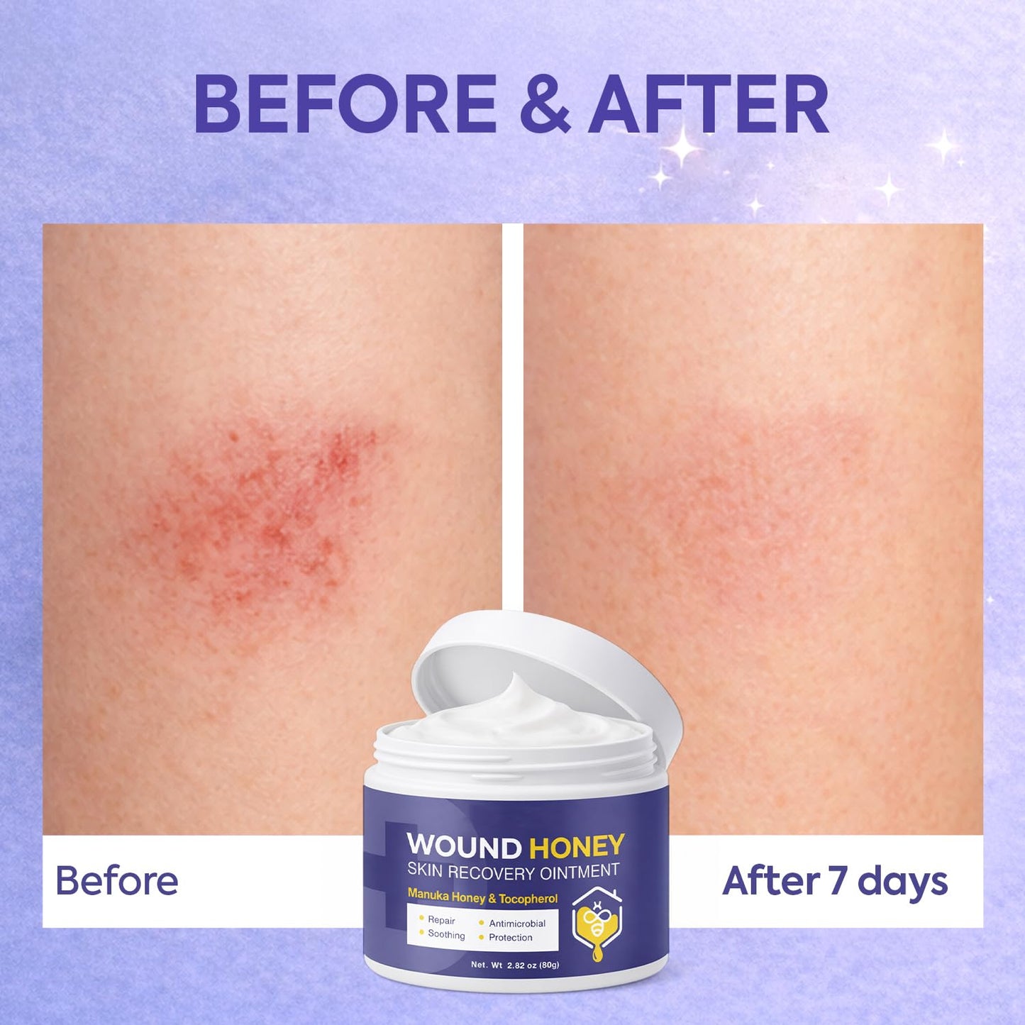 OHEAL Manuka Honey Wound Care Ointment – Moisturizing Barrier Balm for Minor Cuts, Scrapes, Abrasions & Dry Cracked Skin, Gentle Formula for skin care, 2.82 oz
