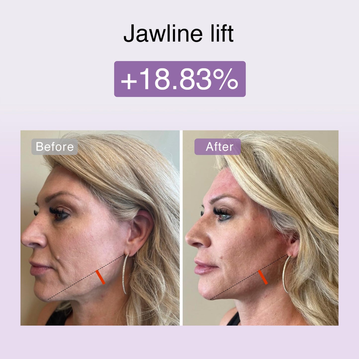 DermRays Multi-Functional Microcurrent Device with 650nm Red Light, 4-in-1 Facial Toning Tool with Multi-Leading Tech for a Visibly Radiant & Youthful Appearance