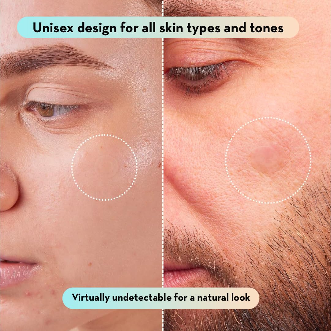 LE GUSHE Korean Pimple Patches for Face (132 Dots) - Hydrocolloid Acne Patches with Tea Tree Oil - Invisible Zit Stickers - Dermatologist Tested - Korean Skin Care