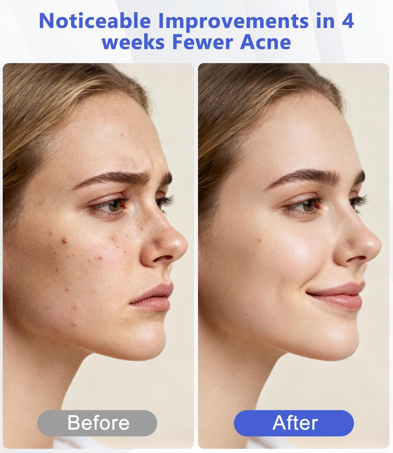 LED Light Therapy Machine FDA Cleared Red, Infrared and Blue Light Therapy, LED Face Mask Light Therapy Skin Care Photon Device for Wrinkle Reduction and Acne, G3