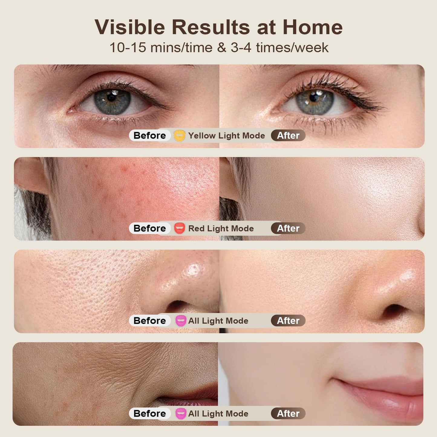 YHYXPO Red Light Therapy Mask for Face