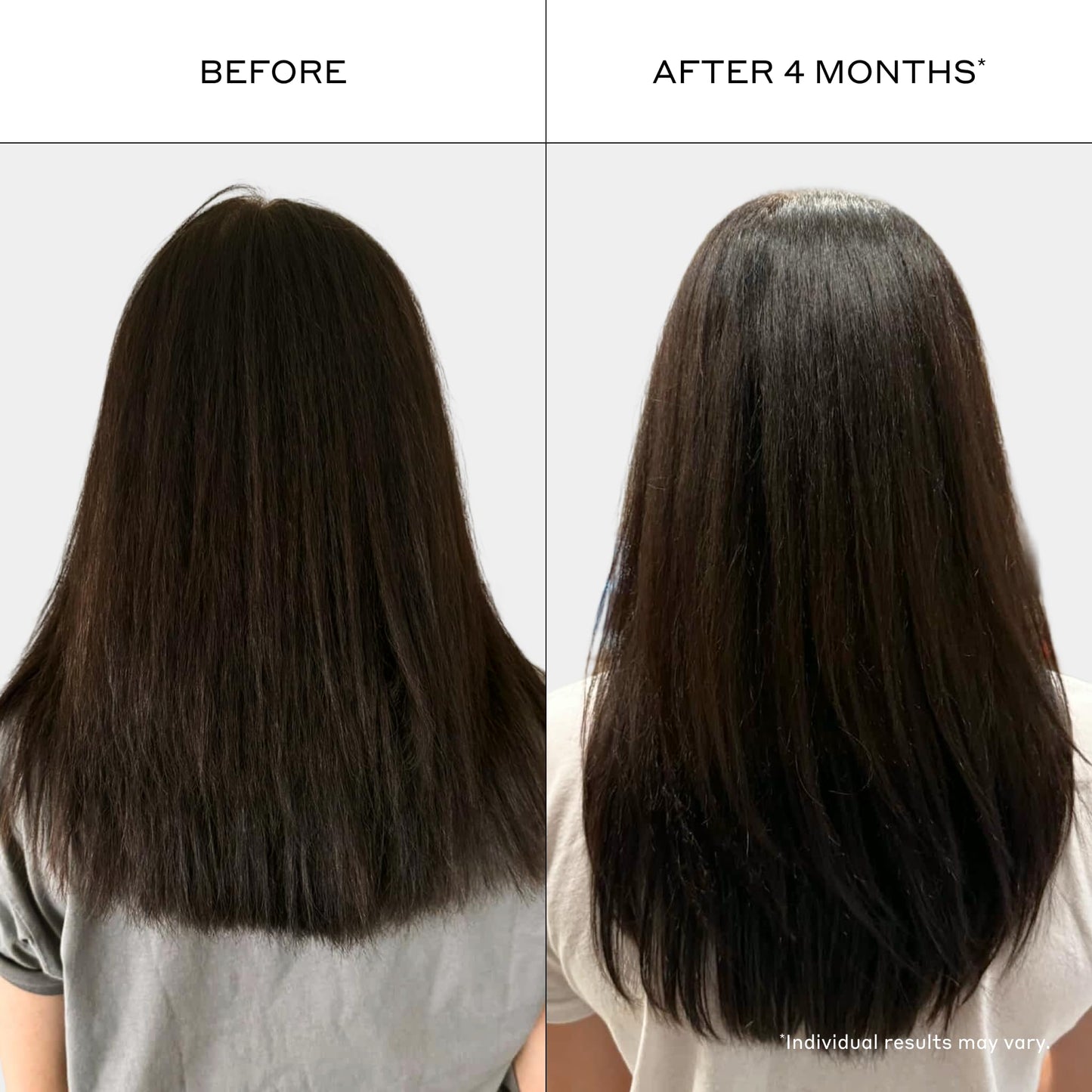 ZENAGEN Revolve Conditioner (Unisex) | Supports Scalp Health & Appearance of Fuller, Healthier Hair, Developed for Fine & Visibly Thinning Hair, Plant-Based, Color-Safe, Vegan, 200 mL / 6.75 oz