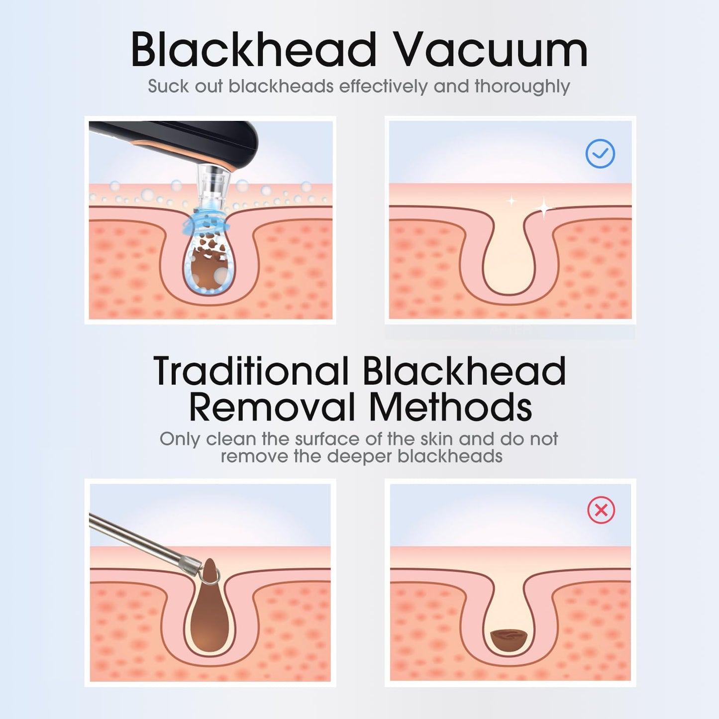 Yccu Blackhead Remover Vacuum Pore Extractor Black Head Remover for Face and Nose Blackhead Extractor Tool Pore Cleane Vacuum with USB Charge 4 Modes 5 Suction Heads for Women and Men (Black)