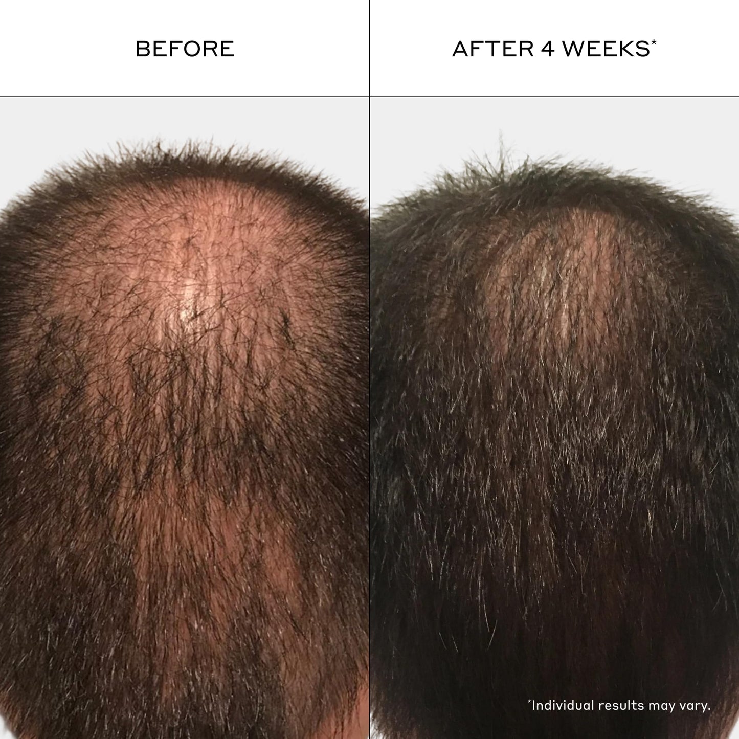 ZENAGEN Revolve Men's Thickening Shampoo | Supports Appearance of Fuller, Healthier-Looking Hair, Developed for Fine & Visibly Thinning Hair, Plant-Based, 5-Minute Treatment, 200 mL / 6.75 oz