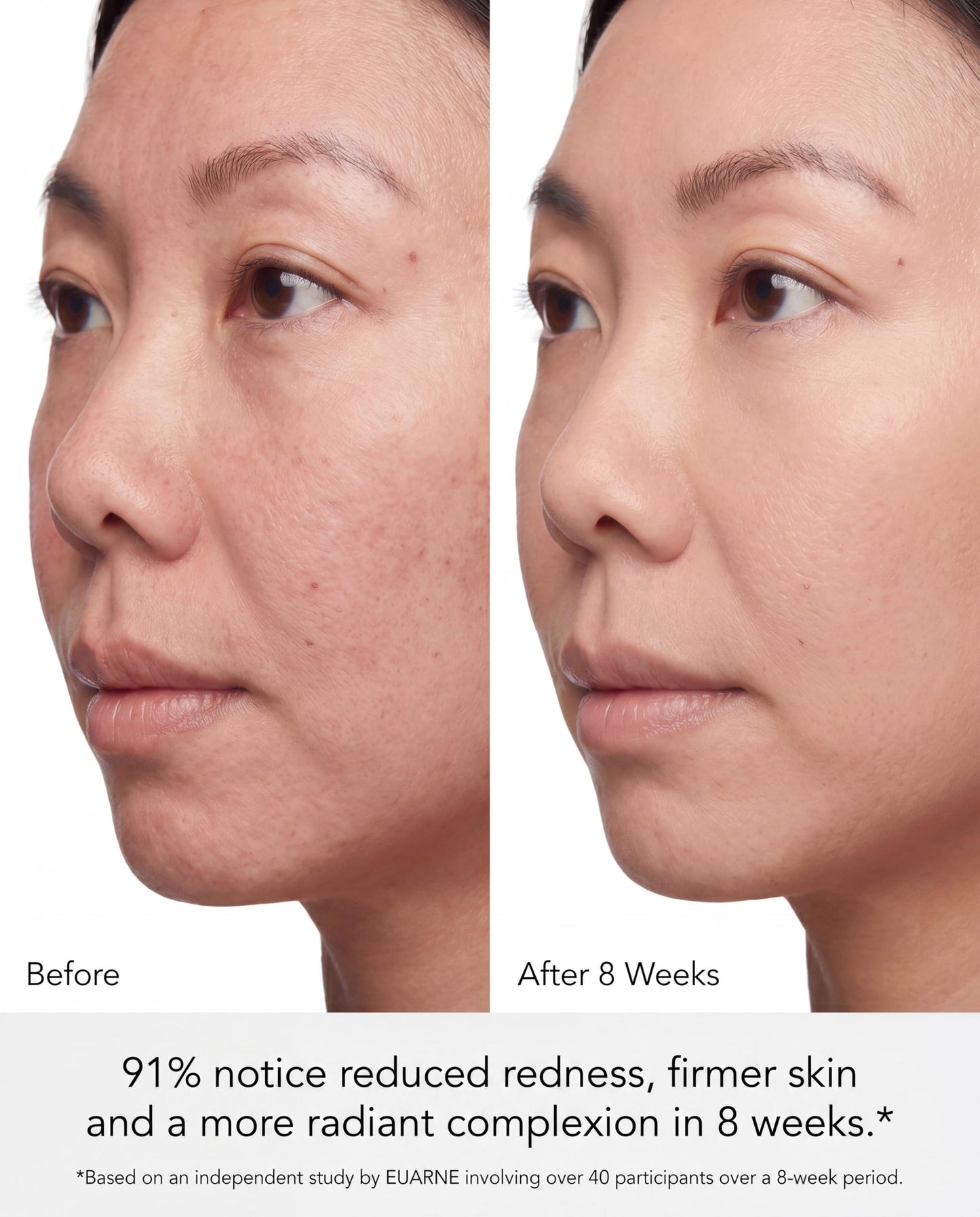 Red Light Therapy for Face, 324 LEDs Red Light Therapy Mask, FDA Cleared 4 Light Modes with Infrared, Red & Blue for Anti-Fine Line, Wrinkle, Acne & Skin Firm