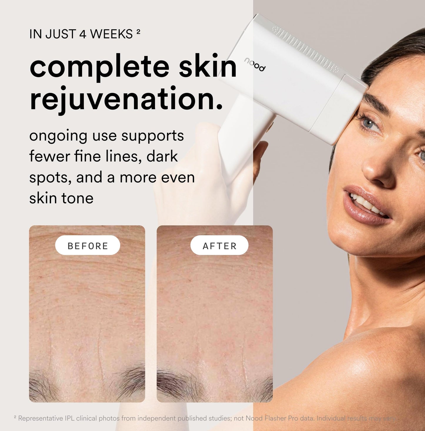 Nood™ Flasher Pro — Forbes Best Product 2026 — IPL Laser Hair Removal Device For At Home Use — Pain-Free, Permanent, Visible Results After First Use & Works Everywhere Hair Grows — Gloss White