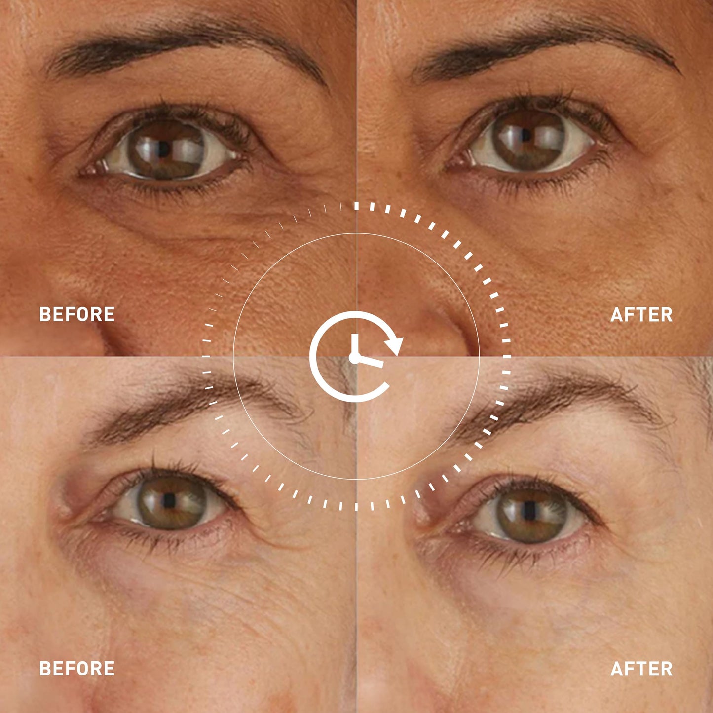skyn ICELAND Hydro Cool Firming Under Eye Patches. Eye Gel Mask to Firm And Reduce Wrinkles, Fine Lines, Dark Circles, Puffy Eyes & Bags, 4 Pairs