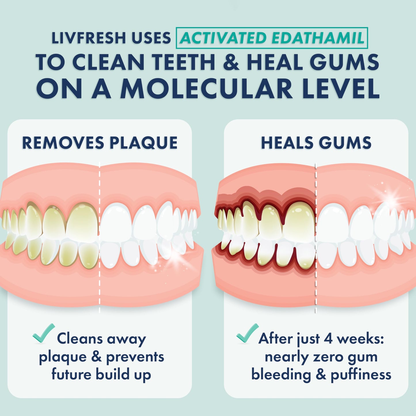 LIVFRESH Toothpaste Gel, Clinically Proven to Remove Plaque 250% Better, Improves Gum Health 190% Better, Prevents & Reduces Tartar, Freshens Breath, SLS Free Dental Gel, Wintergreen, 2 Pack