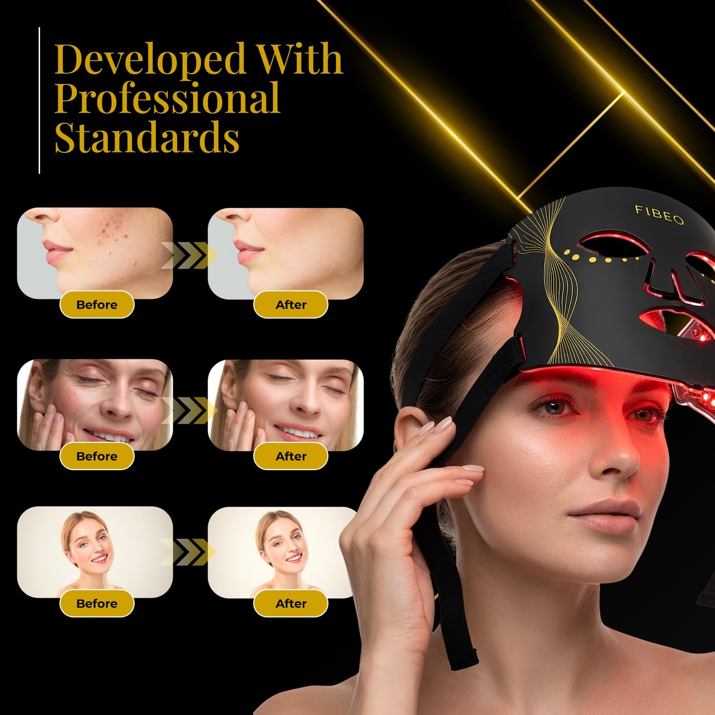 FIBEO LED Red Light Therapy Mask for Face, FDA-Cleared 630nm Red, 850nm Near-Infrared & 415nm Blue Light, 324 LED Chips, 3 Modes, 5 Intensity Levels, Remote Controller – At-Home Skin Care Device
