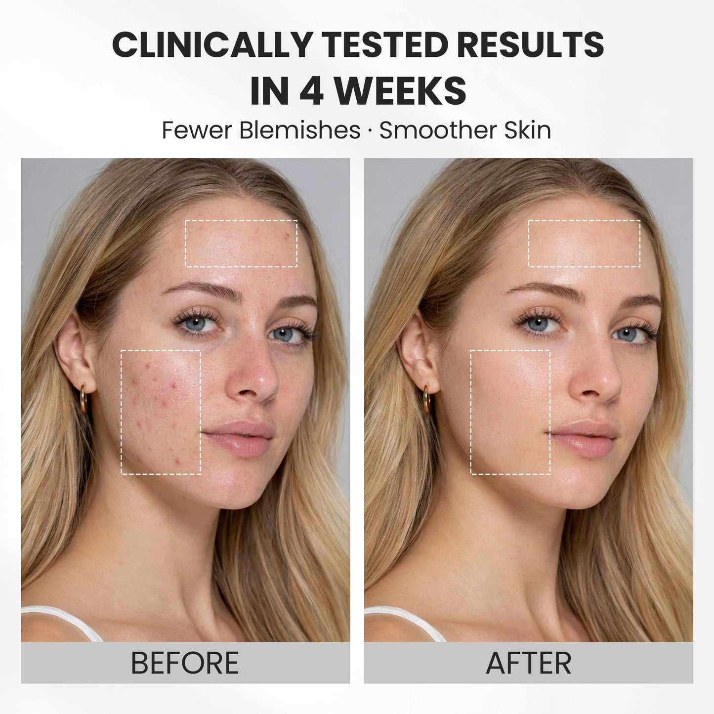 Red Light Therapy for Face, Wireless LED Face Mask 850nm Infrared, 4 Modes Anti-Aging Acne Device, 272 LEDs Red Blue Amber Light Therapy, Cordless Rechargeable for Home & Travel