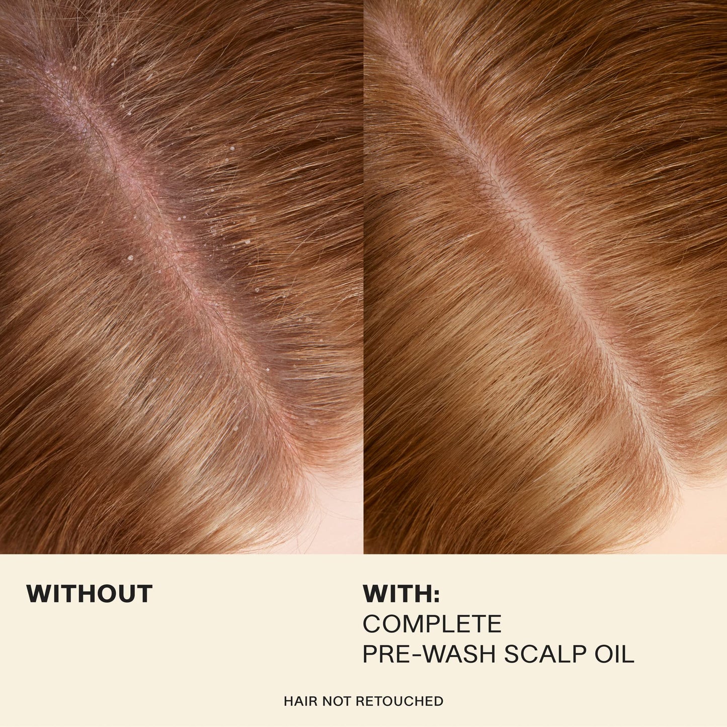 JVN Complete Pre-Wash Scalp Oil, 1.7 Fl Oz, Hair Treatment and Scalp Clarifying Oil Made with Rosemary Extract, Hair Care for Women and Men, Silicone Free