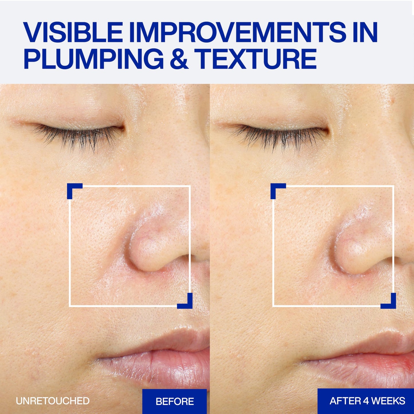 IOPE XMD Stem III Clinical Recovery Serum - Professional PDRN Treatment-Level Results - Visibly Firms, Plumps Volume, and Refines Pores - With Hyaluronic Acid - 1.01 fl. oz.