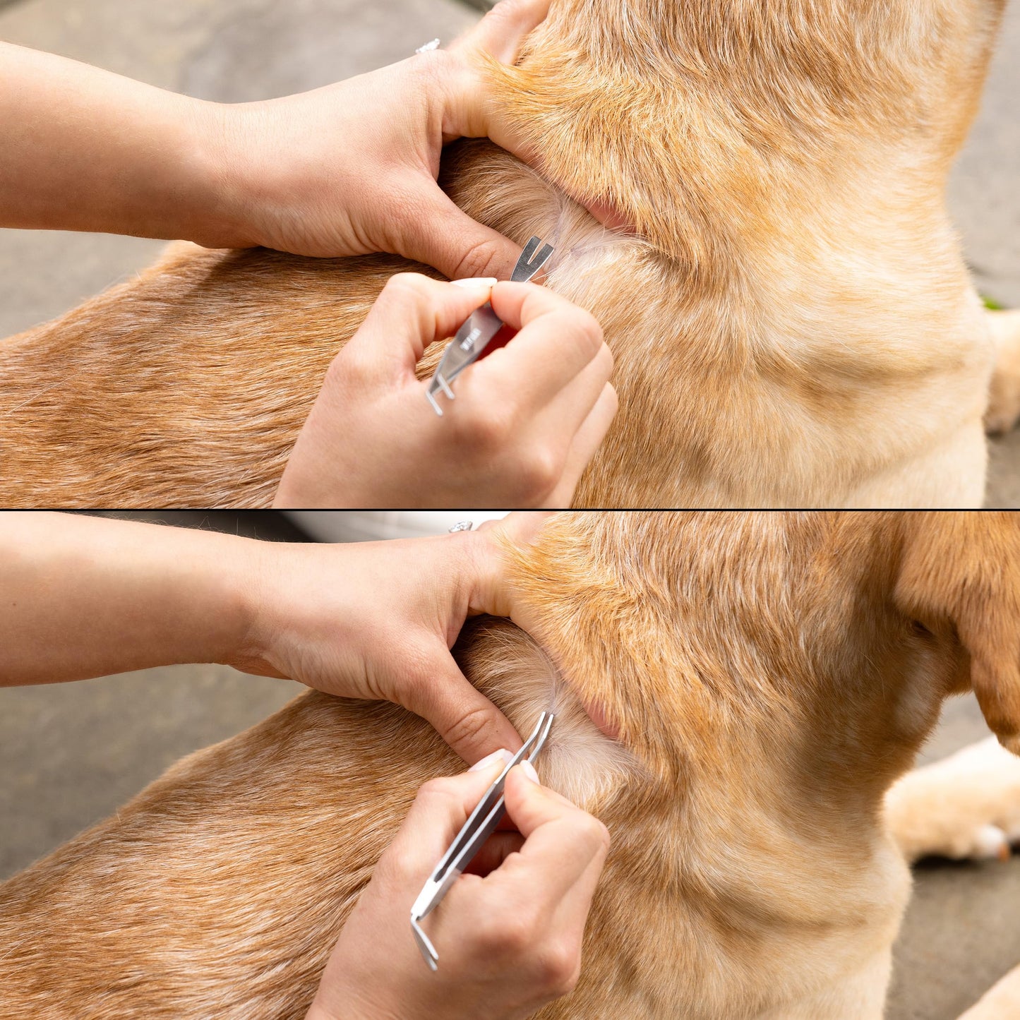 Tweezerman Precision Dual-Sided Tick Removal Tweezer & Case